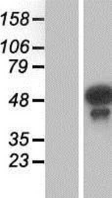 Western Blot: Testin Overexpression Lysate [NBP2-07137]