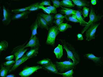 Immunocytochemistry/ Immunofluorescence: Testis expressed 264 Antibody [NBP2-98192]