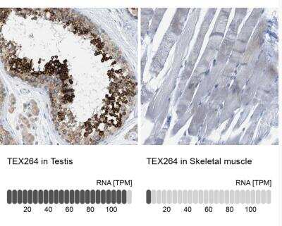 Immunohistochemistry-Paraffin: Testis expressed 264 Antibody [NBP1-89866]