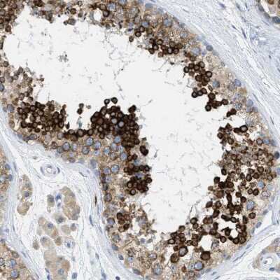Immunohistochemistry-Paraffin: Testis expressed 264 Antibody [NBP1-89866]