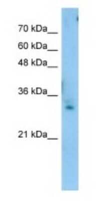 Western Blot: Testis expressed 264 Antibody [NBP1-62424]