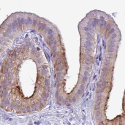 Immunohistochemistry: Testis serine protease 5 Antibody [NBP2-31815]