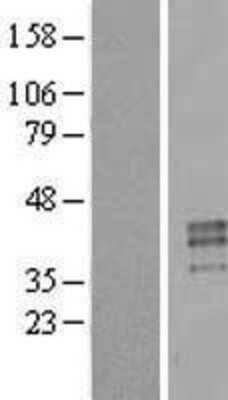 Western Blot: Testisin/Prss21 Overexpression Lysate [NBL1-14844]