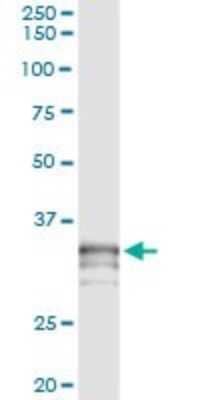 Immunoprecipitation: Testisin/Prss21 Antibody (2E10) [H00010942-M01]