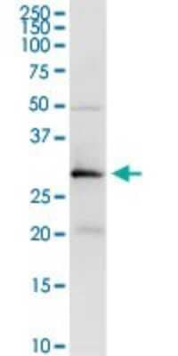 Western Blot: Testisin/Prss21 Antibody [H00010942-D01P]