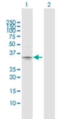 Western Blot: Testisin/Prss21 Antibody [H00010942-D01P]