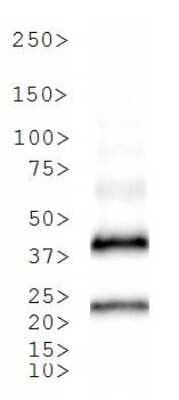 Western Blot: TetR AntibodyBSA Free [NBP1-78424]