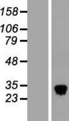 Western Blot: CLEC3B/Tetranectin Overexpression Lysate [NBL1-09258]