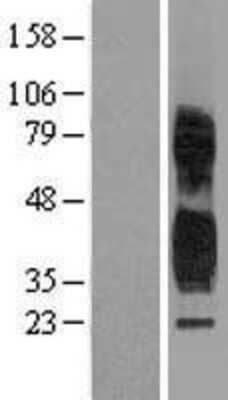 Western Blot: TSPAN1 Overexpression Lysate [NBP2-10447]