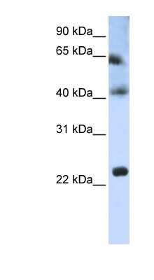 Western Blot: TSPAN3 Antibody [NBP1-62310]