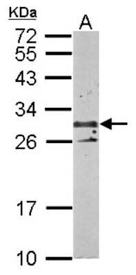 Western Blot: TSPAN3 Antibody [NBP2-20604]