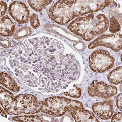 Immunohistochemistry-Paraffin: Tetraspanin-31 Antibody [NBP2-33838]