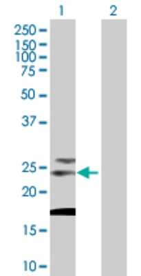 Western Blot: Tetraspanin-31 Antibody [H00006302-B02P]