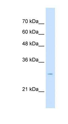 Western Blot: TSPAN32/TSSC6 Antibody [NBP1-62492]