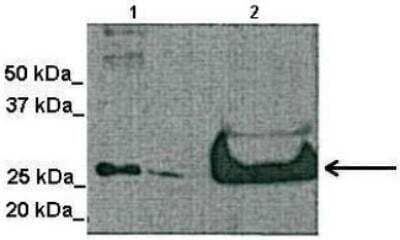 Western Blot: Tetraspanin-4 Antibody [NBP1-59438]