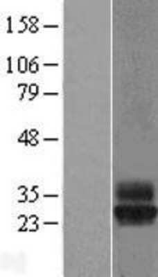 Western Blot: Tetraspanin-4 Overexpression Lysate [NBL1-17376]