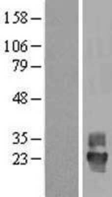 Western Blot: Tetraspanin-4 Overexpression Lysate [NBL1-17378]