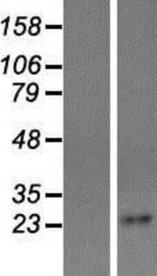 Western Blot: Tetraspanin-4 Overexpression Lysate [NBP2-11043]