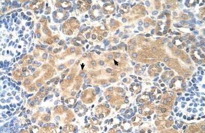 Immunohistochemistry: Tetraspanin-5 Antibody [NBP1-69337]