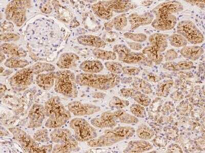 Immunohistochemistry: Tetraspanin-5 Antibody [NBP3-06184]