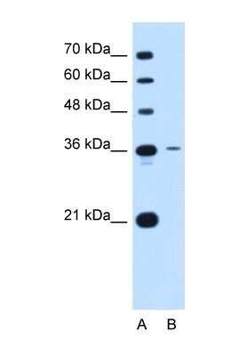 Western Blot: Tetraspanin-5 Antibody [NBP1-69337]