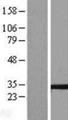 Western Blot: Tetraspanin-5 Overexpression Lysate [NBL1-17379]