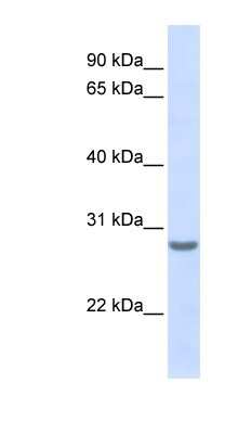 Western Blot: TSPAN6 Antibody [NBP1-59047]