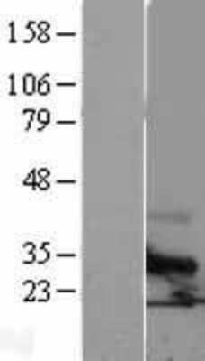 Western Blot: TSPAN6 Overexpression Lysate [NBL1-17380]