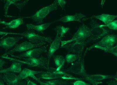 Immunocytochemistry/ Immunofluorescence: TfR (Transferrin R) Antibody (040) [NBP2-89744]