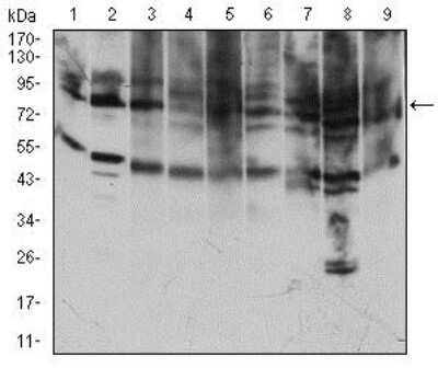 Western Blot: TfR (Transferrin R) Antibody (1A1B2)BSA Free [NBP2-37317]