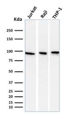 Western Blot: TfR (Transferrin R) Antibody (DF1513)Azide and BSA Free [NBP2-34602]