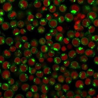 Immunocytochemistry/ Immunofluorescence: TfR (Transferrin R) Antibody (DF1513) [NBP2-32945]