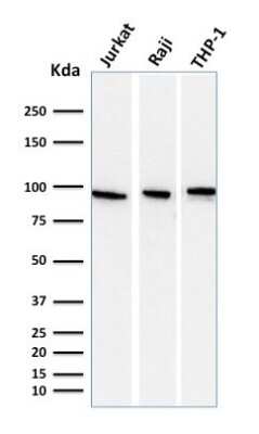 Western Blot: TfR (Transferrin R) Antibody (DF1513) [NBP2-32945]