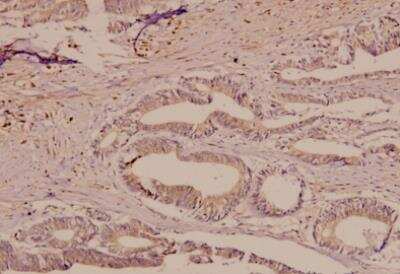 Immunohistochemistry-Paraffin: TfR (Transferrin R) Antibody - BSA Free [NB100-92243]