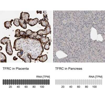 Immunohistochemistry-Paraffin: TfR (Transferrin R) Antibody [NBP1-85741]