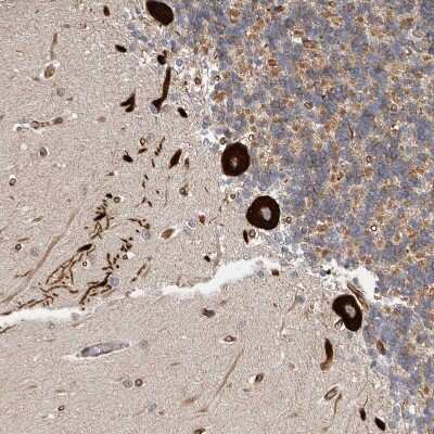 Immunohistochemistry-Paraffin: TfR (Transferrin R) Antibody [NBP1-85741]
