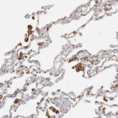 Immunohistochemistry-Paraffin: TfR (Transferrin R) Antibody [NBP1-85741]