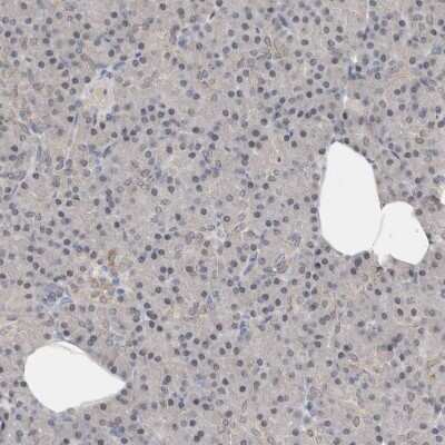 Immunohistochemistry-Paraffin: TfR (Transferrin R) Antibody [NBP1-85741]