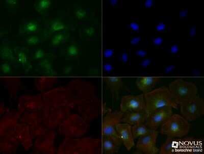 Immunocytochemistry/ Immunofluorescence: TfR (Transferrin R) Antibody (OX26) - Azide and BSA Free [NBP2-80976]