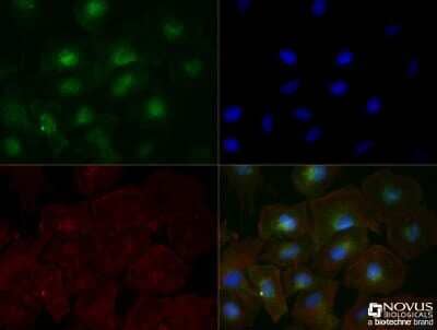 Immunocytochemistry/ Immunofluorescence: TfR (Transferrin R) Antibody (OX26) - BSA Free [NB200-585]