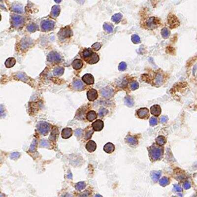 Immunohistochemistry-Paraffin: TfR (Transferrin R) Antibody (OX26) - BSA Free [NB200-585]