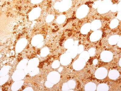 Immunohistochemistry-Paraffin: TfR (Transferrin R) Antibody (TFRC/1817) - Azide and BSA Free [NBP2-54467]