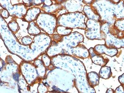 Immunohistochemistry-Paraffin: TfR (Transferrin R) Antibody (TFRC/1817) - Azide and BSA Free [NBP2-54467]