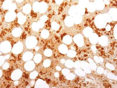 Immunohistochemistry-Paraffin: TfR (Transferrin R) Antibody (TFRC/1818) - Azide and BSA Free [NBP2-54466]