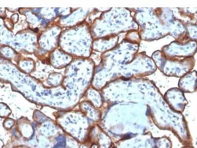 Immunohistochemistry-Paraffin: TfR (Transferrin R) Antibody (TFRC/1818) [NBP2-53283]