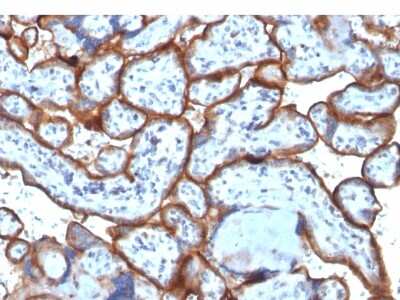 Immunohistochemistry-Paraffin: TfR (Transferrin R) Antibody (TFRC/1818) - Azide and BSA Free [NBP2-54466]