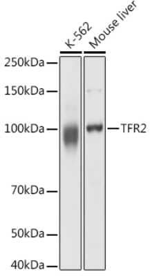 Western Blot: TfR2 AntibodyAzide and BSA Free [NBP2-93436]