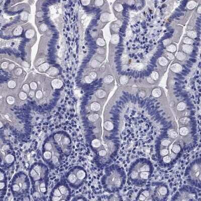 Immunohistochemistry-Paraffin: TfR2 Antibody [NBP3-17003]