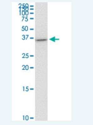 Western Blot: Th-POK Antibody (1D4) [H00051043-M03-100ug]