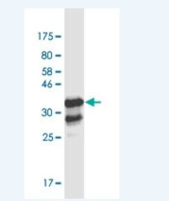 Western Blot: Th-POK Antibody (1D4) [H00051043-M03-100ug]